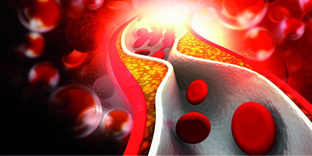 Hiérarchie des anticoagulants oraux