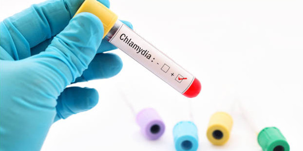 Dépistage systématique de la chlamydiose