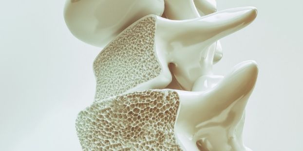 Limiter les fractures en cas d’ostéoporose