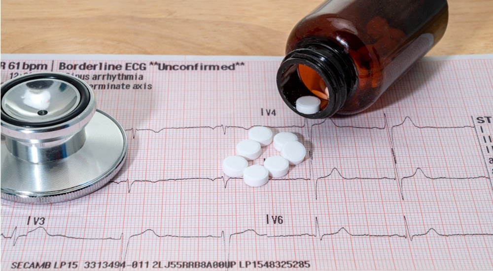 Tableau de test ECG avec des pilules et un stéthoscope