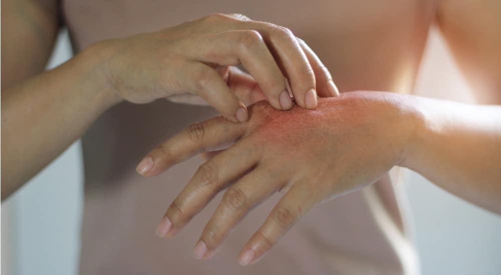 Livmarli® : une avancée pour le traitement du prurit cholestatique chez les patients atteints du syndrome